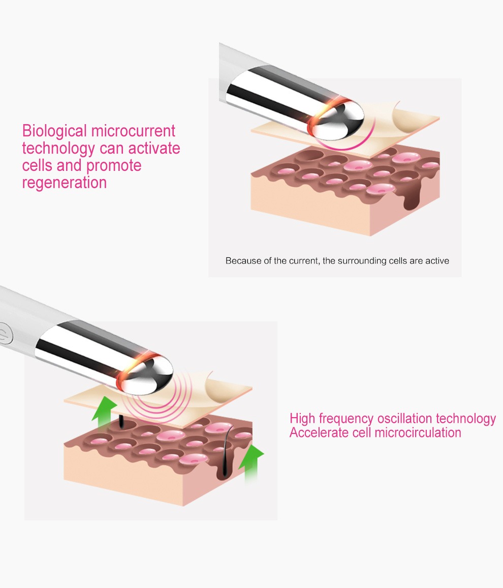 Beauty Eye Massager USB újratölthető arcmasszírozó bőrápoló készülék részletei